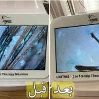 درمان قطعی شوره ،چربی،و انواع ریزش های مو|خدمات آرایشگری و زیبایی|اصفهان, چشمه باقرخان|دیوار