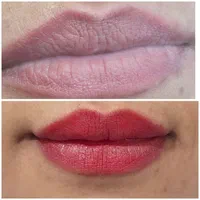 تخفیف ویژه آرایش دائم و رفع سیاهی لب