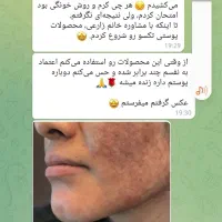 با ما پوستی بدون لک و جوش را تجربه کنید