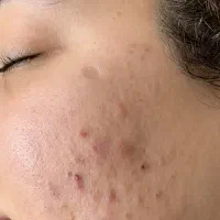 نتیجه کرم تخصصی