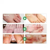 اسپری گیاهی ضدبو و درمان زخم پا حجم 30 میلی لیتر|آرایشی، بهداشتی، درمانی|اصفهان, جاوان|دیوار