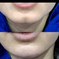 تخفیفات زیبایی و عملهای جراحی|خدمات آرایشگری و زیبایی|دوگنبدان, |دیوار