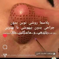 جوانسازی و پلاسماتراپی و مزونیدلینگ|خدمات آرایشگری و زیبایی|فرح آباد, |دیوار