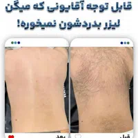 لیزر موج کندلا لیزر آقایان لیزر بانوان|خدمات آرایشگری و زیبایی|اصفهان, نقش جهان|دیوار
