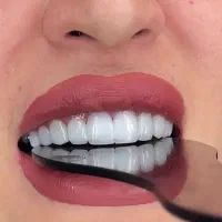 وام دندانپزشکی تا۳۰۰میلیون وقیمت50%کمترازتعرفه