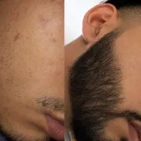 ریش و سبیل خاص و متفاوت