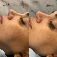 آموزش فشیال فقط۴۵۰۰