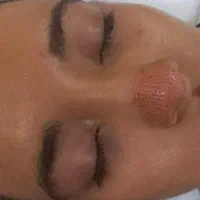 آموزش فیشیال تخصصی. مزو جوانساز صورت|خدمات آموزشی|کوهدشت, |دیوار