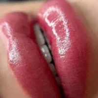 فیبروز و میکروبلیدینگ و شیدینگ لب