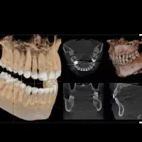 راهنمایی  عکس رادیولوژی  cbct