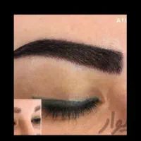 کاشت ابرو، شقیقه، سر، نقدو. اقساط|خدمات زیبایی و سلامت|تهران, فرمانیه|دیوار