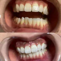 خدمات دندانپزشکی با شرایط ویژه|خدمات آرایشگری و زیبایی|زنجان, |دیوار