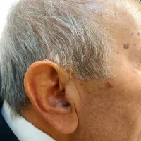 فروش سمعک دیجیتال|آرایشی، بهداشتی، درمانی|مشهد, احمدآباد|دیوار