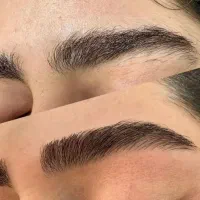 اصلاح صورت و اپلاسیون