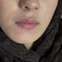 لاغری تضمینی با بازگشت وجه|خدمات زیبایی و سلامت|اصفهان, رکن الدوله شرقی|دیوار