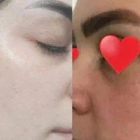 فروش همه نوع لوازم آرایشی درمانی چاقی لاغری ضدلک