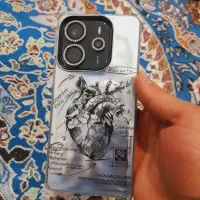 گوشی ردمی نوت ۱۴|موبایل|آبیک, |دیوار