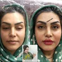 تزریق ژل و بوتاکس و آموزش حرفه ای|خدمات آرایشگری و زیبایی|اهواز, سپیدار|دیوار