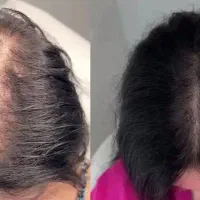 شونه توی موهات گیر میکنه