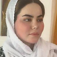 تزریق چربی ساکشن چربی ژل بوتاکس مزو چال گونه|خدمات آرایشگری و زیبایی|قم, بنیاد|دیوار