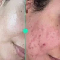 زیبایی پوست و مو