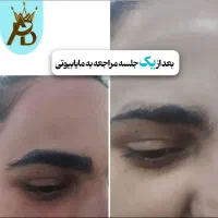 اولین مرکز تخصصی ریموو تتو ابرو و بدن(مایابیوتی)