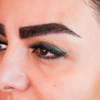 کاشت ابرو با تکنیک انحصاری