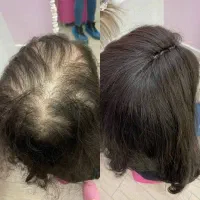 درمان تمامی مشکلات پوست مو