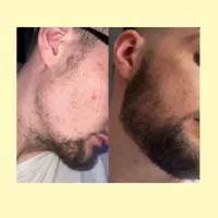 معجزه ریش و سبیل