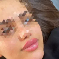 ژل و بوتاکس