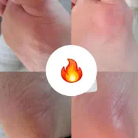 پدیکور و مانیکور حرفه ای با تخفیف تابستانه|خدمات آرایشگری و زیبایی|کرج, بنیاد|دیوار
