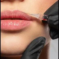 انجام ژل و بوتاکس روی مدل ( فقط هزینه مواد)