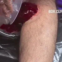 حجامت عام و خاص ،بادکش سرد وگرم وماساژ درمانی