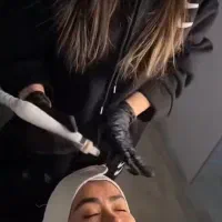 خدمات فیشال و لیزر تخفیف بلک فرایدی|خدمات آرایشگری و زیبایی|قائمشهر, |دیوار