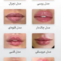 تزریق ژل و بوتاکس و لیزر موهای زائد|خدمات آرایشگری و زیبایی|شیراز, آزادگان|دیوار