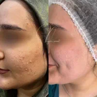 مدل جهت کار درمان تلفیقی پوست