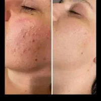 کرم سفید کننده شب (آنتی استاین )ترکیب آمپولی|آرایشی، بهداشتی، درمانی|بم, |دیوار