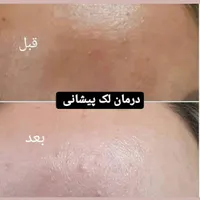 کرم وی آی پی (VIP) اصل|آرایشی، بهداشتی، درمانی|تهران, زعفرانیه|دیوار