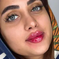ژل لب ۳۰۰ بوتاکس آنزیم لیفت کانتورینگ ساکشن غبغب|خدمات آرایشگری و زیبایی|تهران, سعادت‌آباد|دیوار