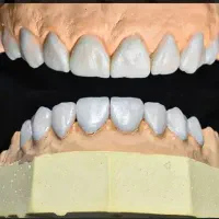 دندان سازی مدرن