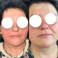 پوست صاف|خدمات آرایشگری و زیبایی|تهران, قبا|دیوار