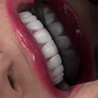 دندانپزشکی با تعرفه دولتی عصب کشی از ۳/۲۰۰|خدمات زیبایی و سلامت|کرج, فاز ۳ گوهردشت|دیوار