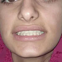 دندانسازی ، دندان مصنوعی|پزشکی|اصفهان, شاهد|دیوار