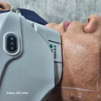 لیزر /فیشال/پیلینگ کربن/پلاژن تراپی/خالبرداری|خدمات آرایشگری و زیبایی|شیراز, تندگویان|دیوار