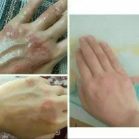 طب سنتی|آرایشی، بهداشتی، درمانی|انگوران, |دیوار