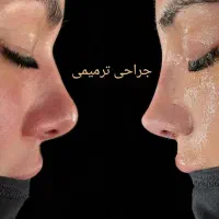 عمل جراحی بینی بامتخصص گوش،حلق،بینی|خدمات آرایشگری و زیبایی|تهران, ونک|دیوار