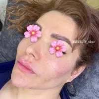 آموزش ژل و بوتاکس|خدمات آموزشی|تهران, جوادیه تهرانپارس|دیوار