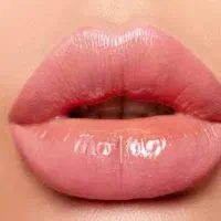 تزریق ژل و بوتاکس