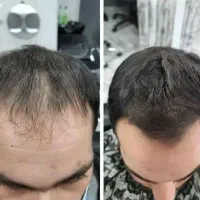 اعتماد به نفس دوباره