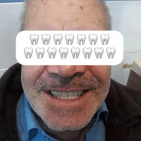 دندانسازی رستمی|خدمات آرایشگری و زیبایی|زنجان, |دیوار